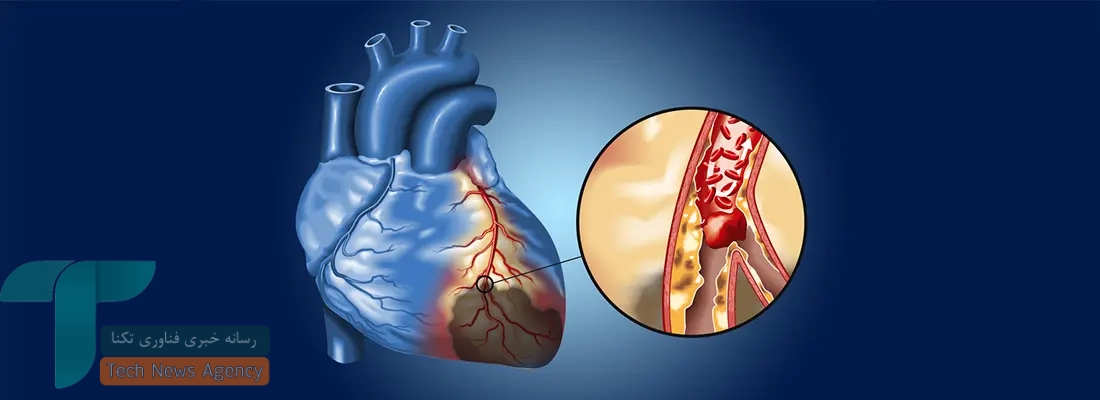 هوش مصنوعی ECG از روشهای معمول در تیراژ رویگرفت رگ قلب پیشی میگیرد